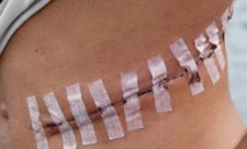 Costa Rica Trafficking Human Organs