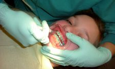 Dental Problems Bullying