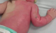 Costa Rica Children Hospital