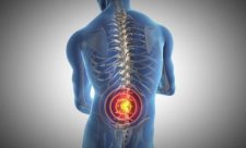 Spinal Cord Injuries
