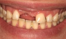 Dental Care Costa Rica